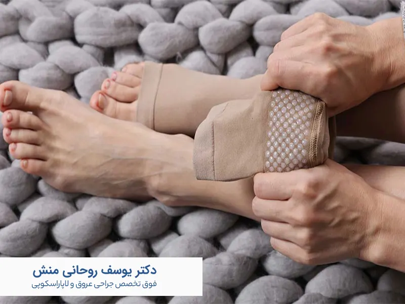 جوراب واریس