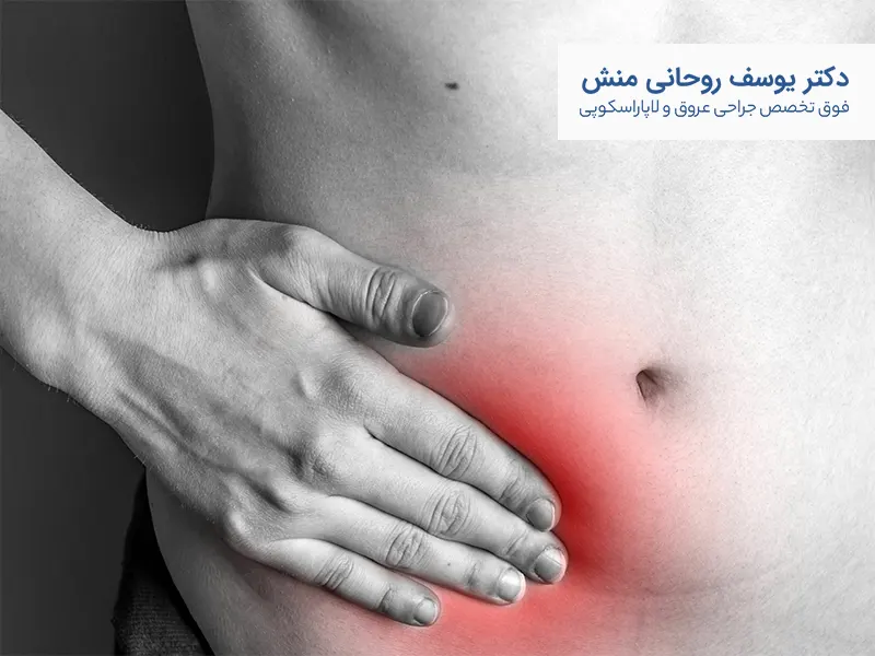 درمان فتق کشاله ران