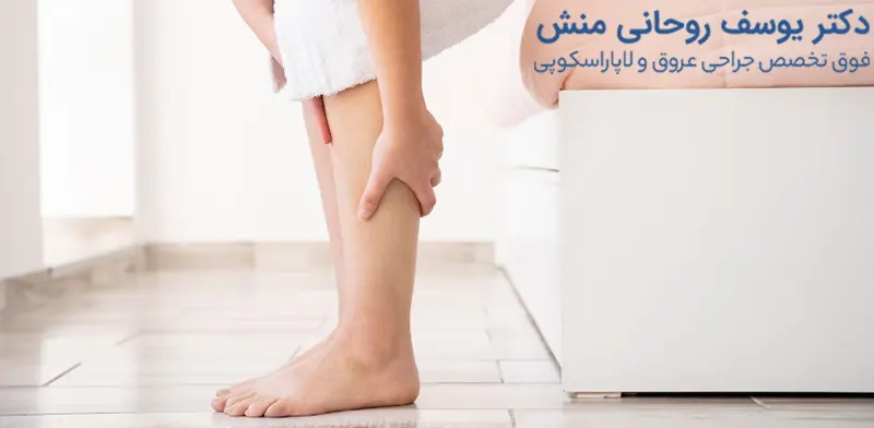 علت واریس در زنان
